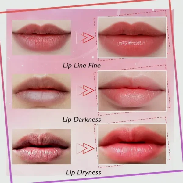 Collagen Lip Masks - Moisturize & Plump