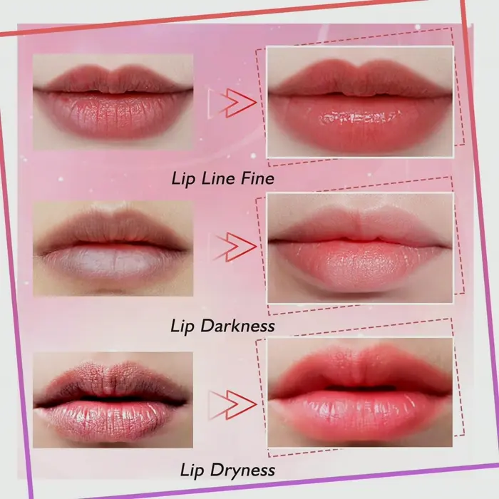 Collagen Lip Masks - Moisturize & Plump