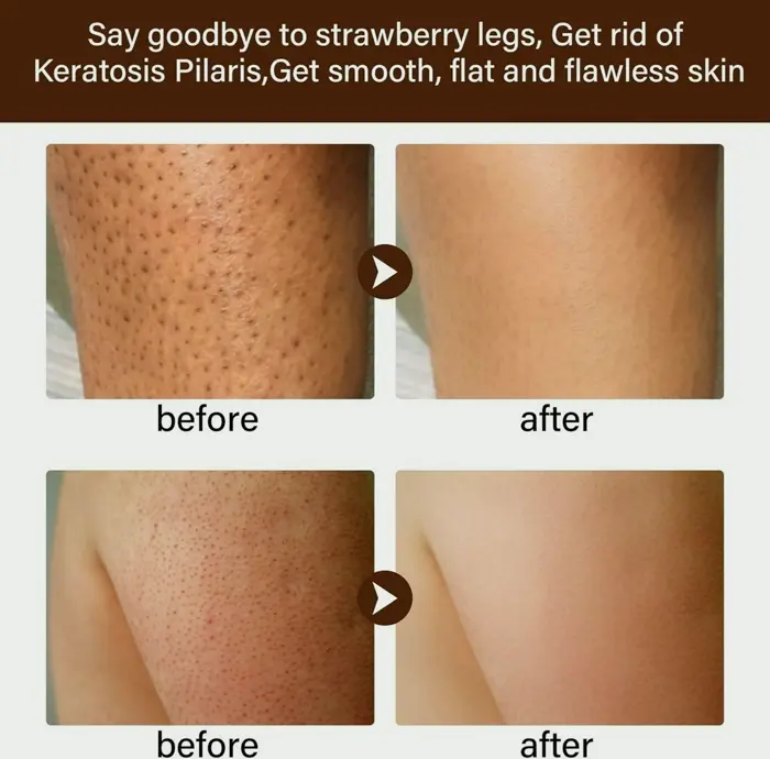 Strawberry Legs Care Solution for Women