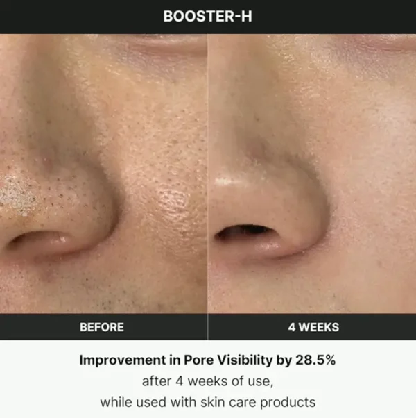 Korean Skincare Gadget - Medicube Age-R Booster H