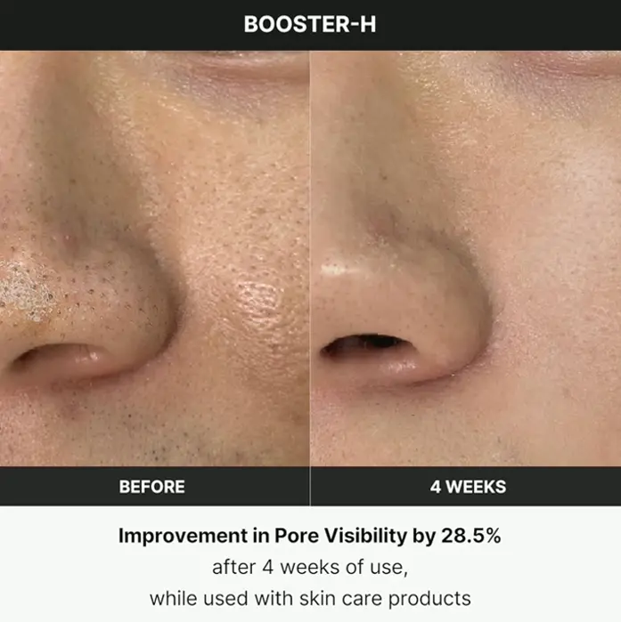 Korean Skincare Gadget - Medicube Age-R Booster H