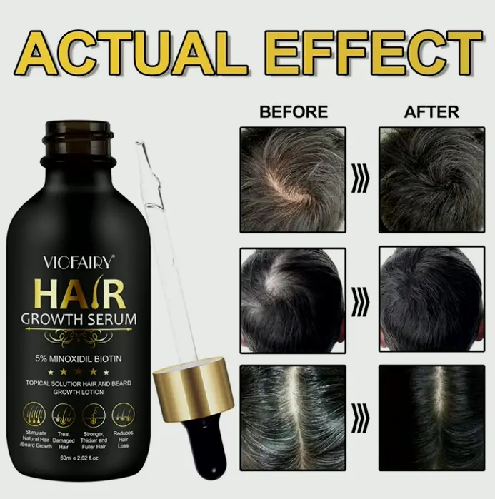 Hair Growth Serum with 5% Minoxidil for Women