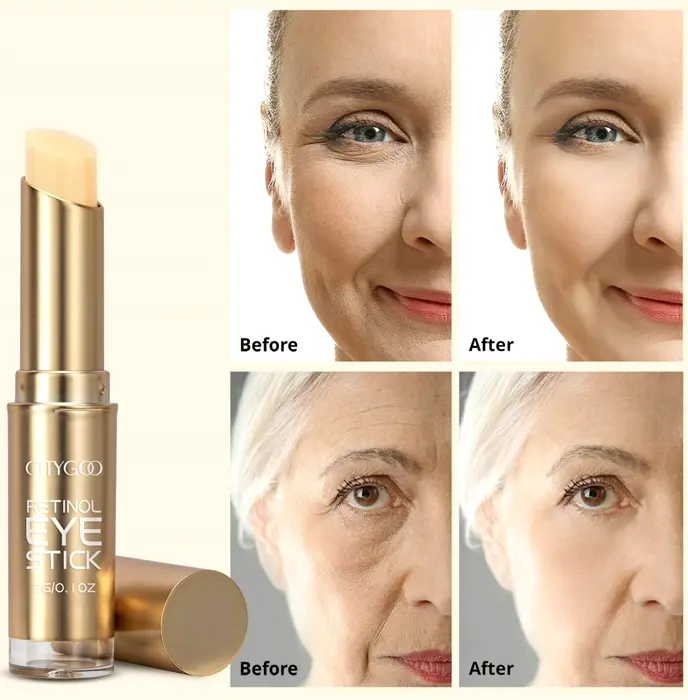 Retinol Eye Balm for Dark Circles & Wrinkles