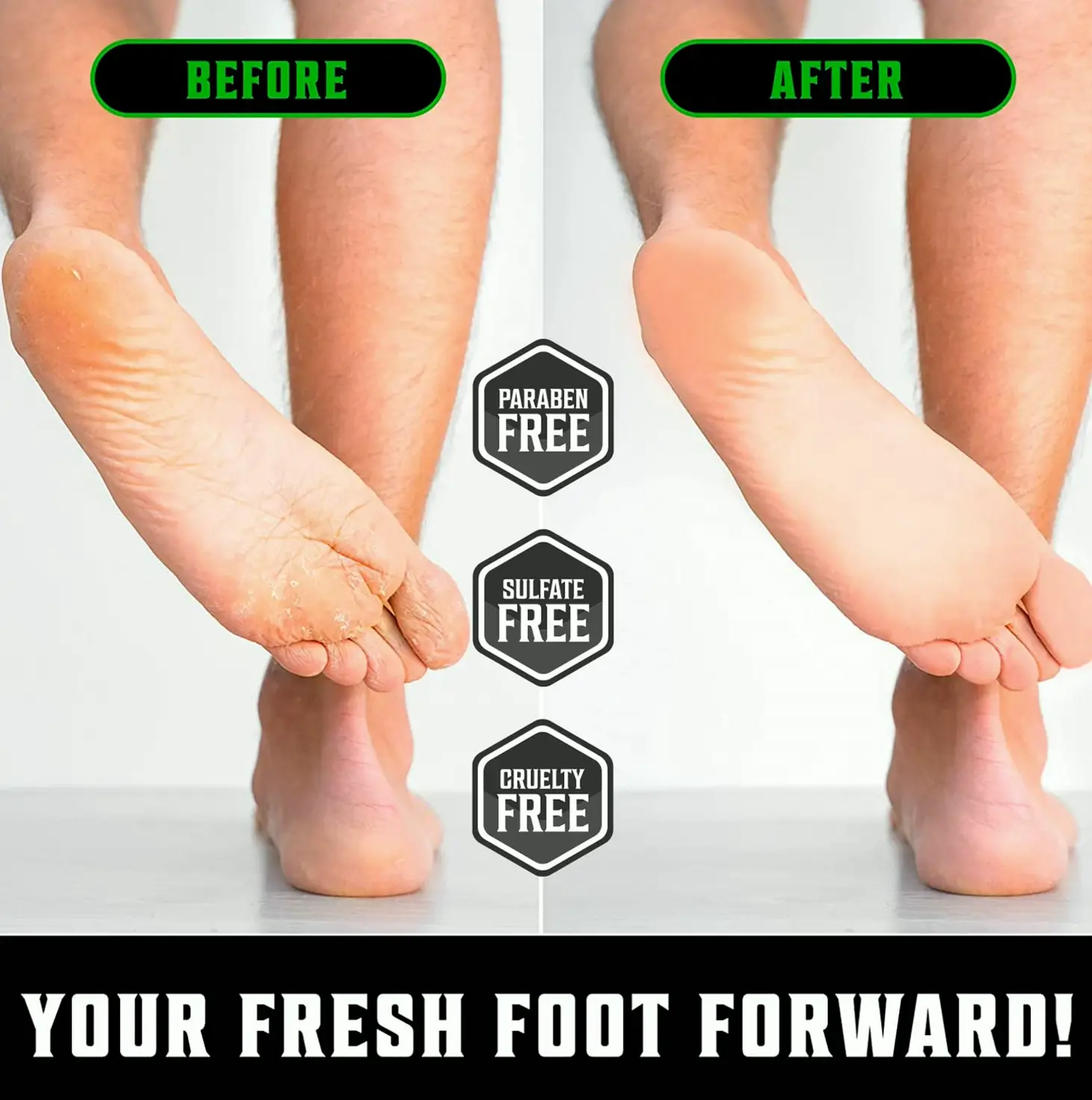 Tea Tree Foot Balm for Cracked Heels Featuring Aloe Vera (8oz)