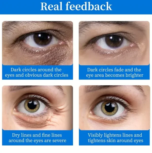 Under Eye Patches (64 pcs) - Illuminating  Eye Treatment with HA, Cooling Care for Puffy Eyes & Discoloration, Reduce Eye Bags and Smooth Wrinkles