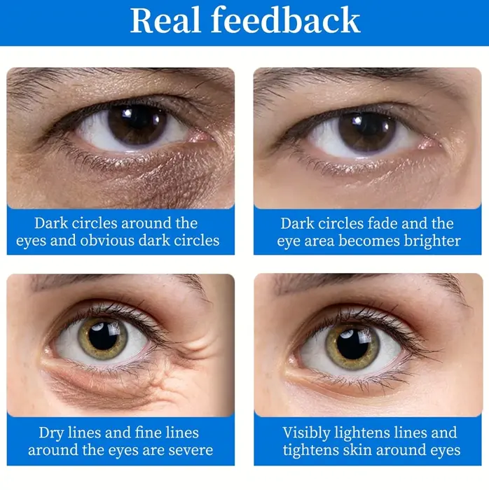 Under Eye Patches (64 pcs) - Illuminating  Eye Treatment with HA, Cooling Care for Puffy Eyes & Discoloration, Reduce Eye Bags and Smooth Wrinkles