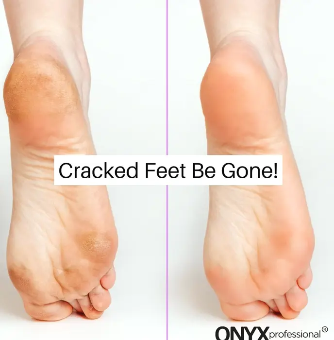 Moisturizing Spa Socks, Dry Feet Care