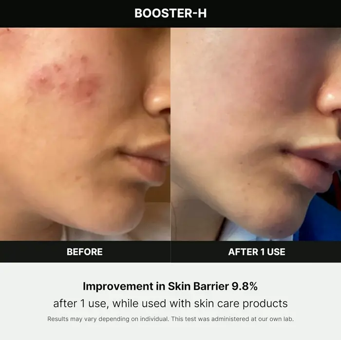 Korean Skincare Gadget - Medicube Age-R Booster H