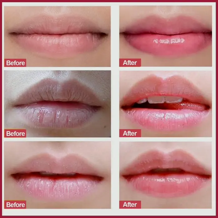 Lip Care Scrub, Natural Polish for Dry Lips
