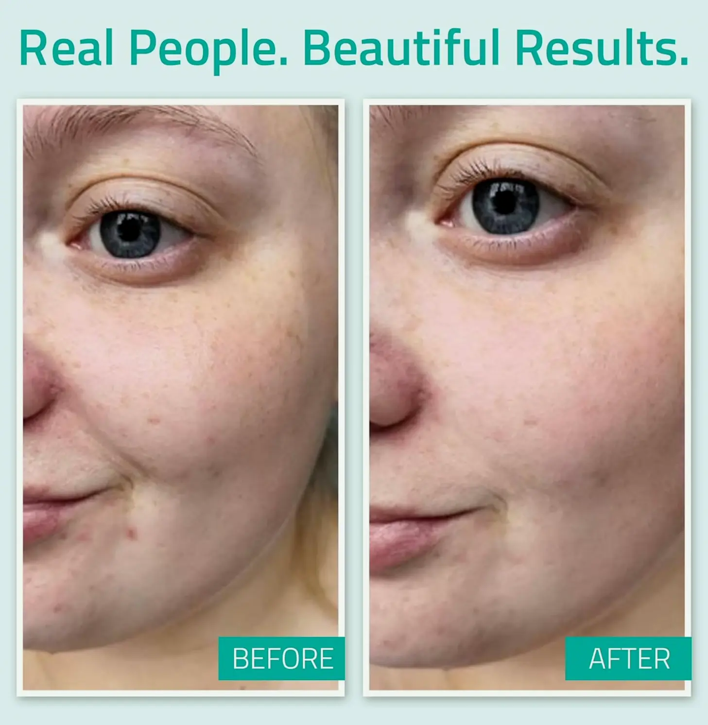Pure Hyaluronic Acid Hydrating Serum for Tired Complexion