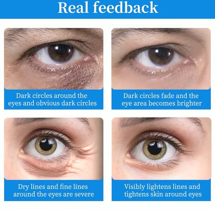 Under Eye Patches (Sixty-four Pieces) – Chilling & Luminous Hyaluronic Acid Eye Care