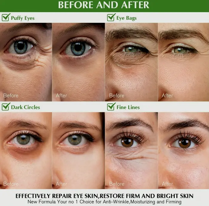 Under-eye Patches to Puffiness